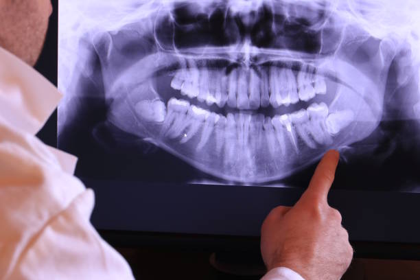 Dentist for Dental Trauma in MT